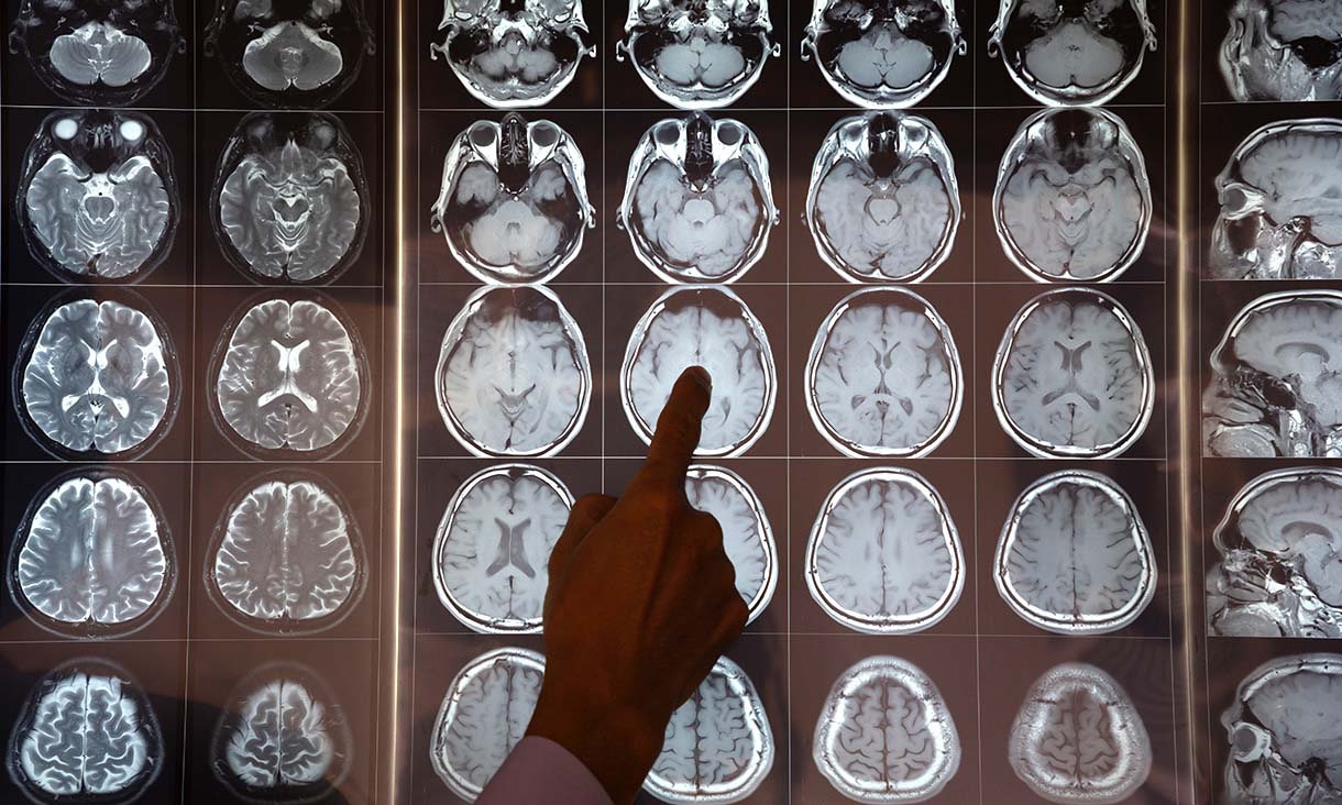 Finger pointing at x-ray images of the brain