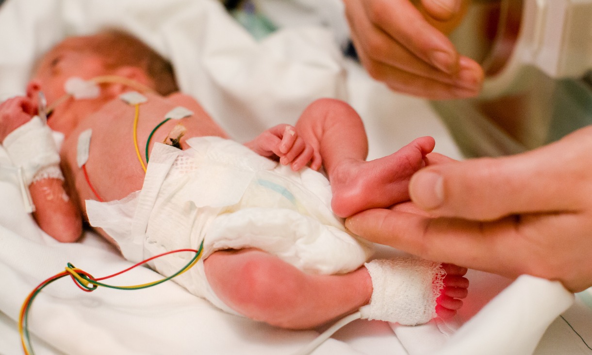 Born Too Soon Tackling The Challenges And Risks Of Preterm Birth 
