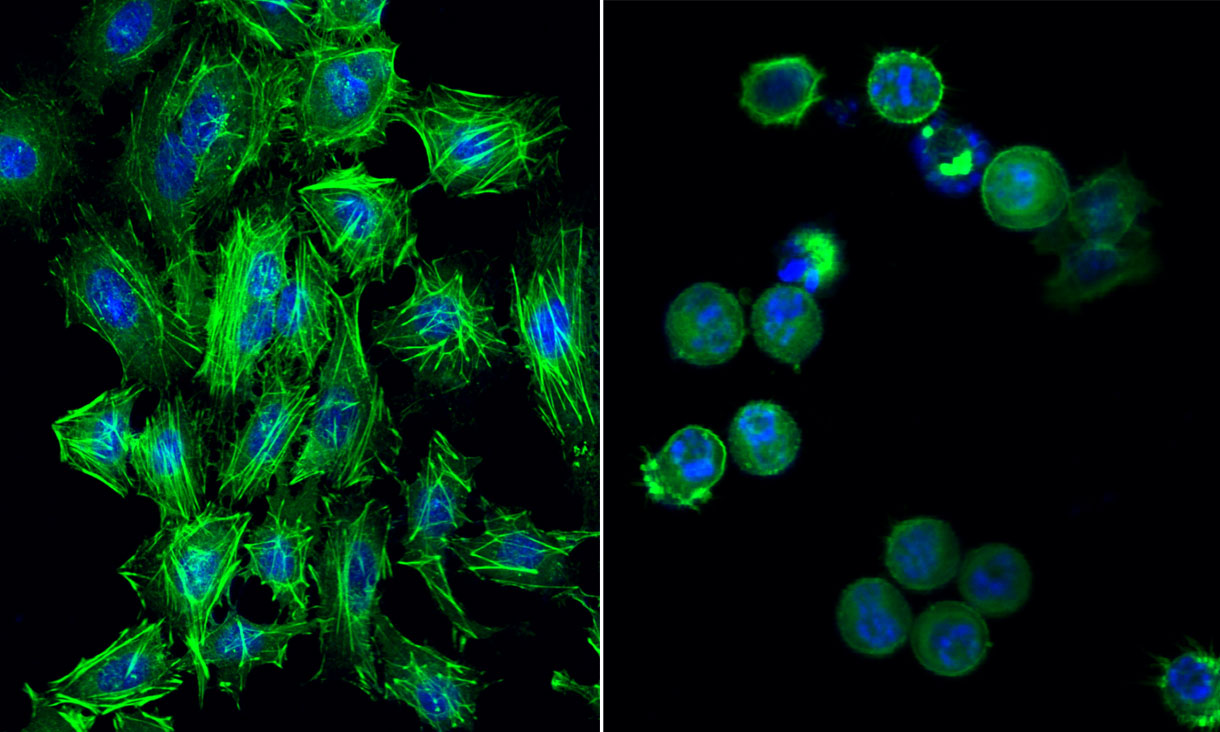 Left: Normal cervical cancer cells with well-formed nuclei in blue and elongated actin filaments – which play an essential role in cell survival and division – in green. Right: Destabilised cervical cancer cells after gold compound treatment show structural integrity compromised while the nuclei in blue are breaking apart, indicating cell death.